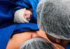 ¿Cómo cambia el cráneo de los bebés al nacer? Cómo cambia el cráneo de los bebés al nacer