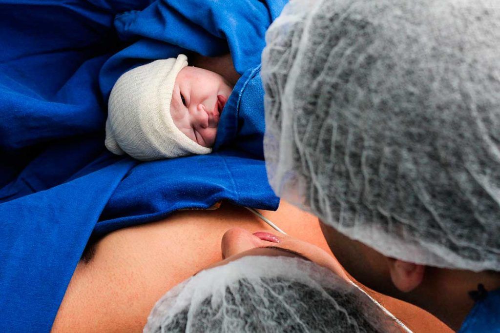 Cómo cambia el cráneo de los bebés al nacer