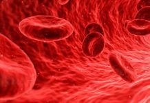 Identificado nuevo oncogén causante de los tumores sanguíneos más frecuentes tumores sanguíneos