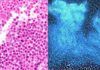 Bacterias, ‘caballos de Troya’ contra el cáncer Bacterias caballos de Troya contra el cáncer