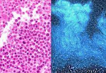 Bacterias, ‘caballos de Troya’ contra el cáncer Bacterias caballos de Troya contra el cáncer