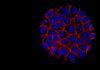 Prometedor tratamiento contra el cáncer de páncreas Prometedor tratamiento contra el cáncer de páncreas
