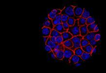 Prometedor tratamiento contra el cáncer de páncreas Prometedor tratamiento contra el cáncer de páncreas