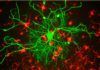 Nanotecnología para trasplantes de células madre Nanotecnología para trasplantes de células madre