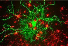 Nanotecnología para trasplantes de células madre Nanotecnología para trasplantes de células madre