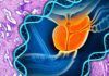 Un gen involucrado en el cáncer de mama también origina cáncer de próstata Detectan mutaciones en otros 11 genes asociados con el cáncer de próstata