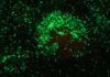 Nanopartículas y ayuno contra la inflamación Nanopartículas y ayuno contra la inflamación