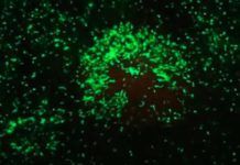 Nanopartículas y ayuno contra la inflamación Nanopartículas y ayuno contra la inflamación