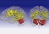¿Hay conexión entre trastorno bipolar y Parkinson? ¿Hay conexión entre trastorno bipolar y Parkinson?