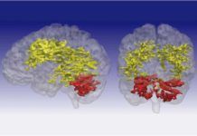 ¿Hay conexión entre trastorno bipolar y Parkinson? ¿Hay conexión entre trastorno bipolar y Parkinson?