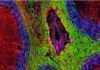 El intestino, clave en la Esclerosis Múltiple El intestino, clave en la Esclerosis Múltiple