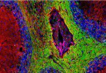 El intestino, clave en la Esclerosis Múltiple El intestino, clave en la Esclerosis Múltiple