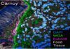 ¿Probióticos frente a la ansiedad? Probióticos frente a la ansiedad