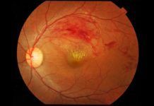 Hallan la causa de la degeneración de la retina Hallan la causa de la degeneración de la retina