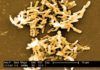 ‘Clostridium difficile’: Identificada su estructura clave ‘Clostridium difficile’: Identificada su estructura clave