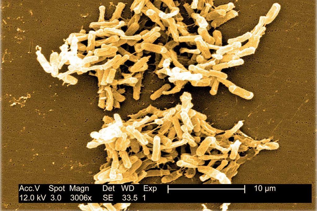‘Clostridium difficile’: Identificada su estructura clave