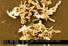 ‘Clostridium difficile’: Identificada su estructura clave ‘Clostridium difficile’: Identificada su estructura clave
