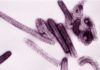Detectan virus de Marburg en Sierra Leona Detectan virus de Marburg en Sierra Leona