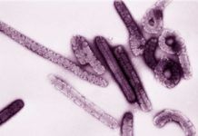 Detectan virus de Marburg en Sierra Leona Detectan virus de Marburg en Sierra Leona