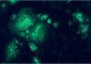 Nueva estrategia contra el coronavirus MERS Nueva estrategia contra el coronavirus MERS