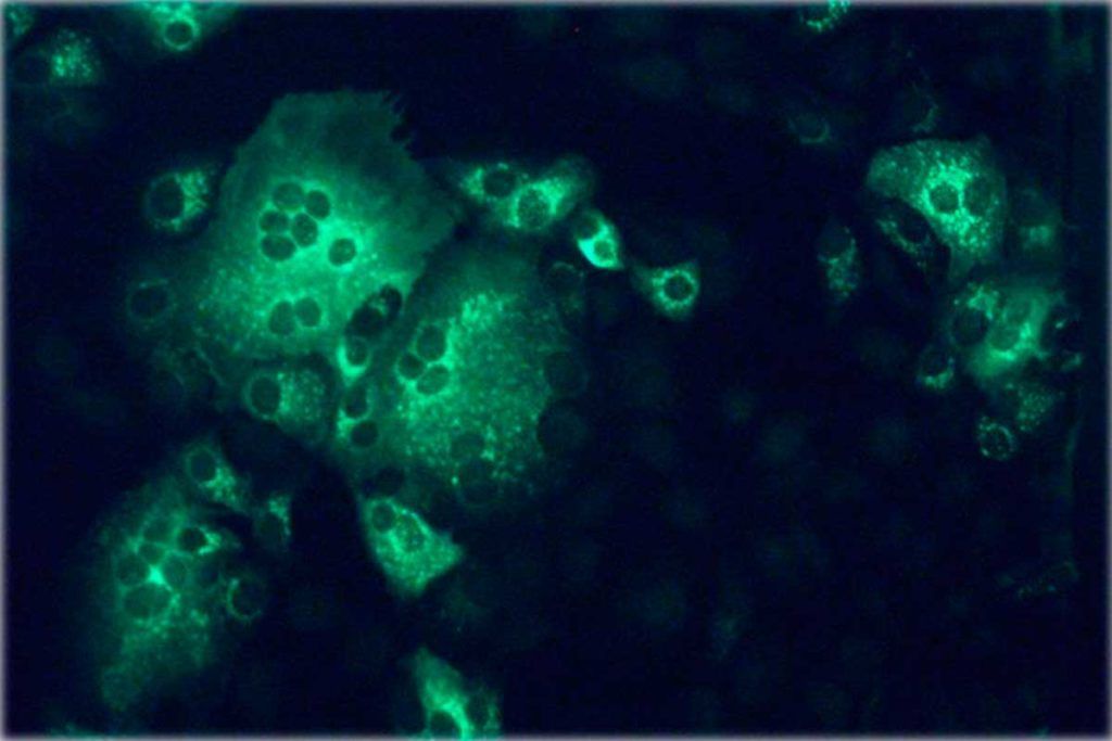 Nueva estrategia contra el coronavirus MERS