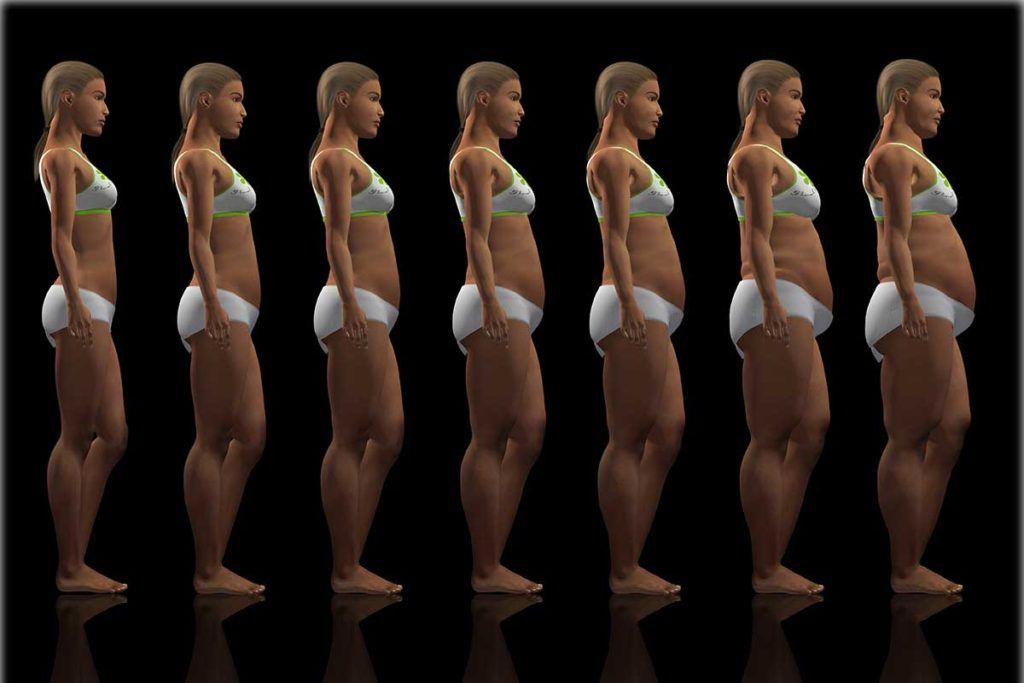 Nueva clasificación de enfermedades vinculadas a la obesidad