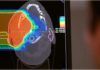 Terapias con haces de iones contra el cáncer Terapias con haces de iones contra el cáncer