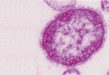 Sarampión: el peligro de no vacunar El virus del sarampión sigue extendiéndose por el mundo