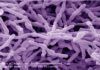 Bifidobacterias, aliadas contra el cáncer Bifidobacterias contra el cáncer