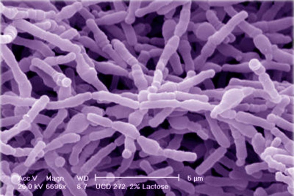 Bifidobacterias contra el cáncer