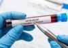 Algunos infectados mantienen SARS-CoV-2 después de desaparecer los síntomas Algunos infectados mantienen el coronavirus después de desaparecer los síntomas