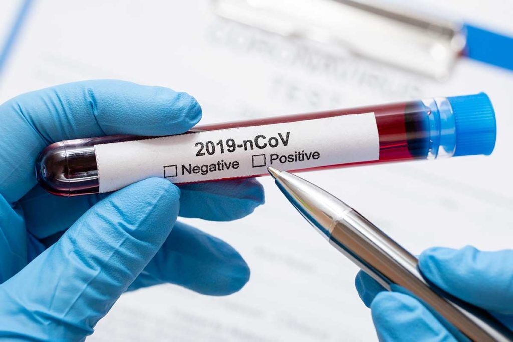 Algunos infectados mantienen el coronavirus después de desaparecer los síntomas