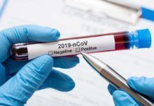 Algunos infectados mantienen SARS-CoV-2 después de desaparecer los síntomas Algunos infectados mantienen el coronavirus después de desaparecer los síntomas