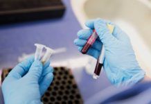 Primer análisis de sangre que detecta con precisión 50 tipos de cáncer Primer análisis de sangre que detecta con precisión 50 tipos de cáncer