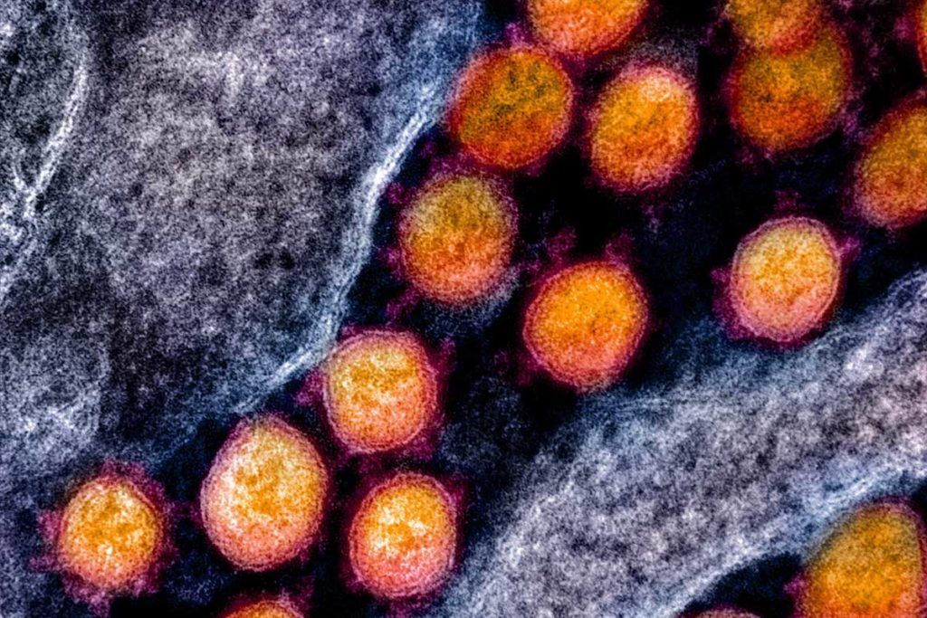 Hallan ‘bala mágica’ que bloquea al coronavirus
