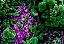 Así mata el nuevo coronavirus