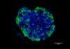 Organoides para combatir el cáncer Organoides para combatir el cáncer