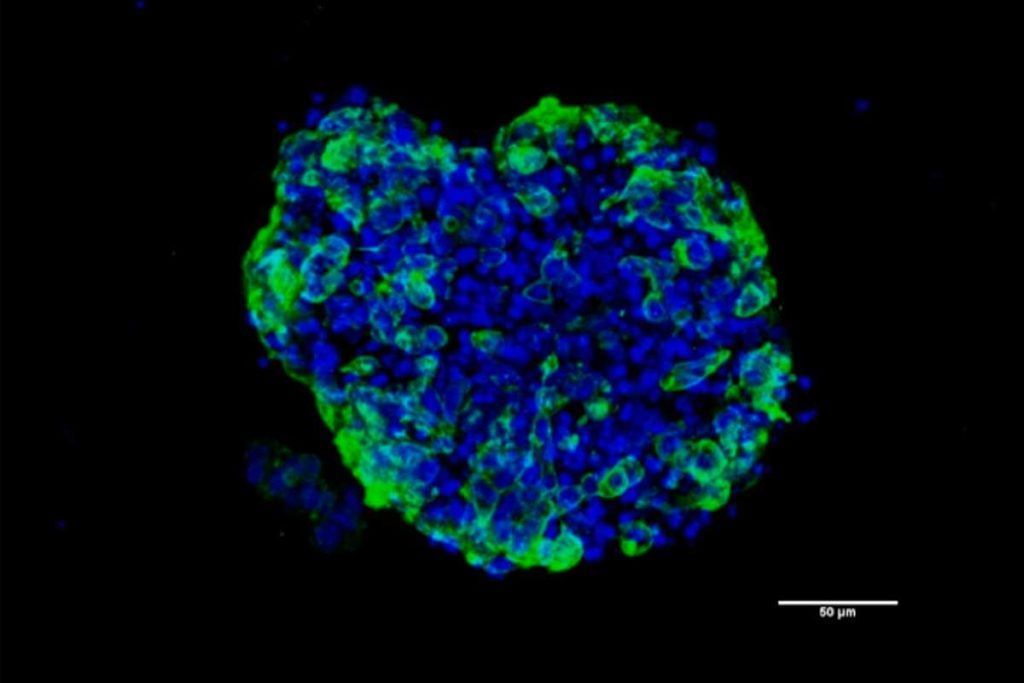 Organoides para combatir el cáncer