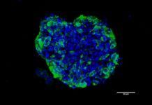 Organoides para combatir el cáncer Organoides para combatir el cáncer