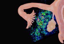 La trompa de Falopio arroja luz para combatir el cáncer de ovario La trompa de Falopio arroja luz para combatir el cáncer de ovario