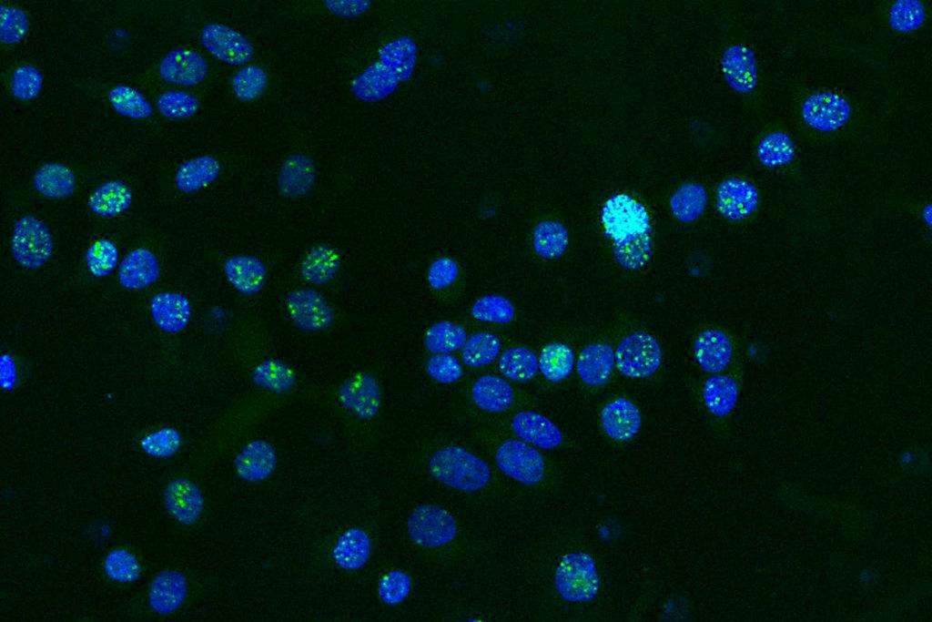 Cómo el cáncer se hace resistente al tratamiento