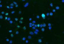 Cómo el cáncer se hace resistente al tratamiento Cómo el cáncer se hace resistente al tratamiento