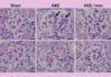 Histamina, un aliado contra el daño renal y cardíaco Histamina, un aliado contra el daño renal y cardíaco
