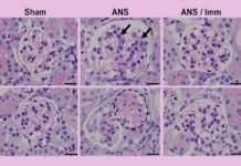 Histamina, un aliado contra el daño renal y cardíaco Histamina, un aliado contra el daño renal y cardíaco