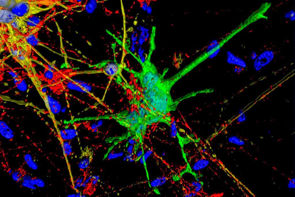 Nueva forma de estudiar el impacto del VIH en el cerebro