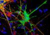 Nueva forma de estudiar el impacto del VIH en el cerebro Nueva forma de estudiar el impacto del VIH en el cerebro