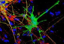 Nueva forma de estudiar el impacto del VIH en el cerebro Nueva forma de estudiar el impacto del VIH en el cerebro