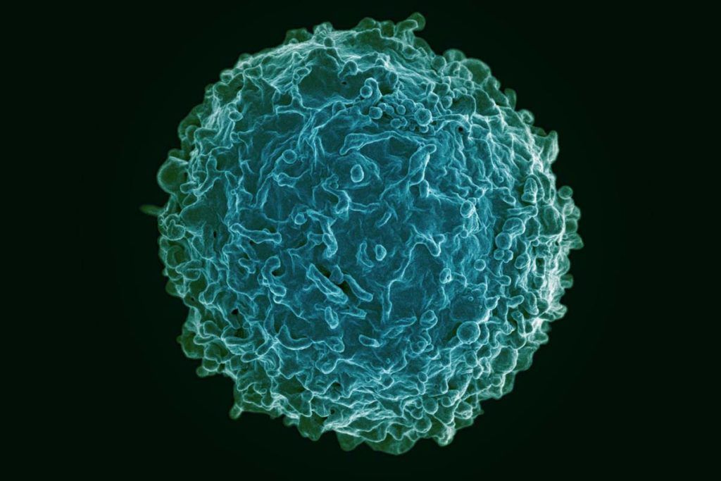 ‘Prime’, las células que detectan brotes de artritis