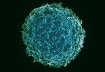 ‘Prime’, las células que detectan brotes de artritis ‘Prime’, las células que detectan brotes de artritis
