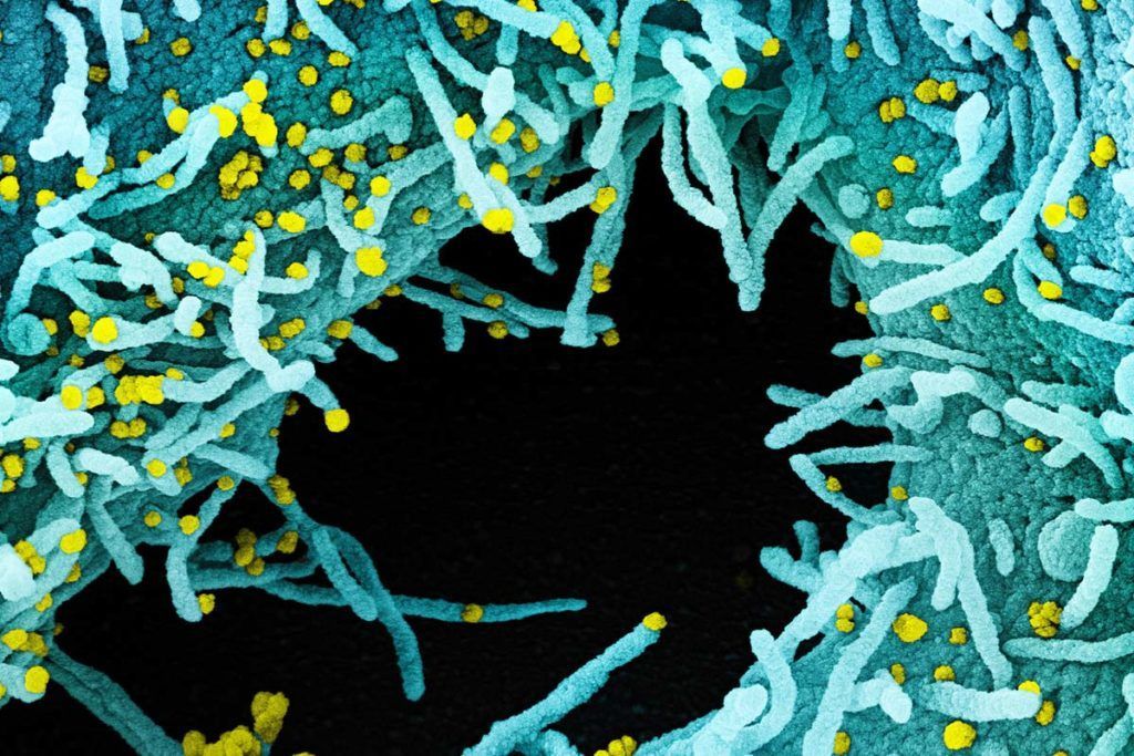Harvard presenta retrato del nuevo coronavirus
